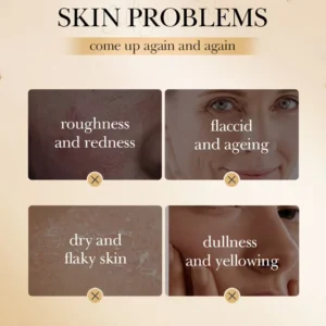 Infographic highlighting skin concerns like dryness and aging addressed by SADOER Collagen Sleeping Face Mask.