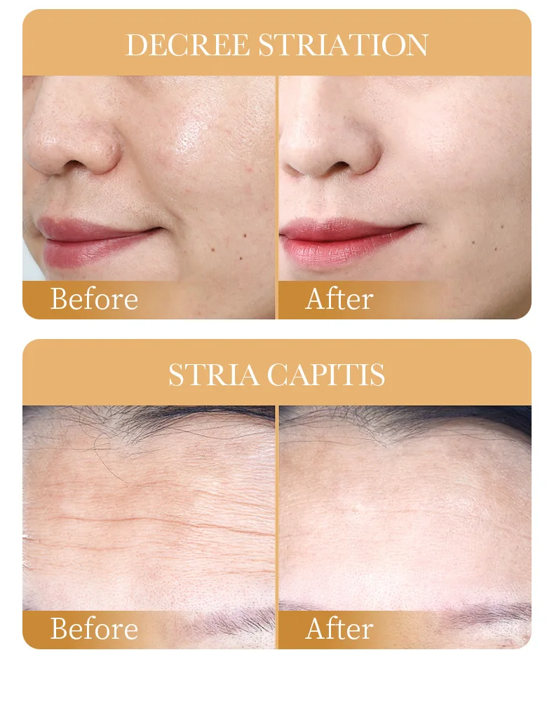 SADOER Collagen Face Sheet Mask product information