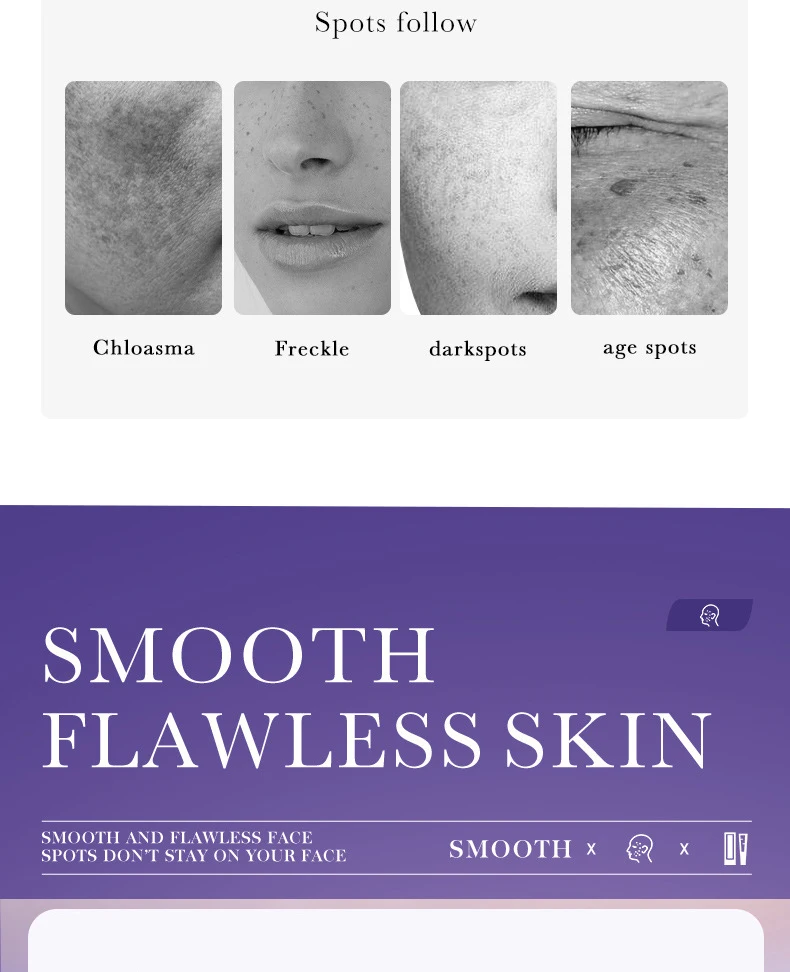 SADOER Nicotinamide Freckle Face Cream product information