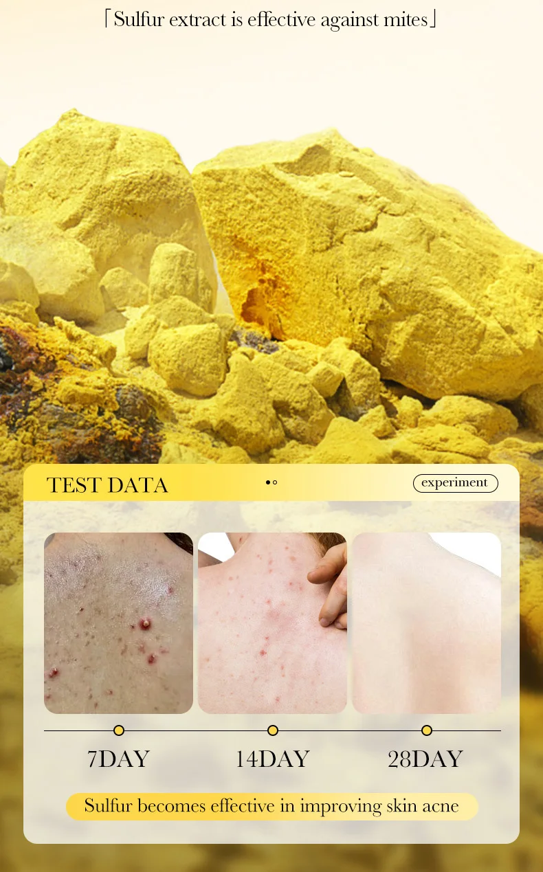 SADOER Sulfur Soap Bar product information