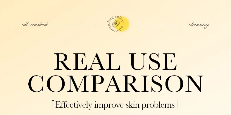 SADOER Sulfur Soap Bar product information