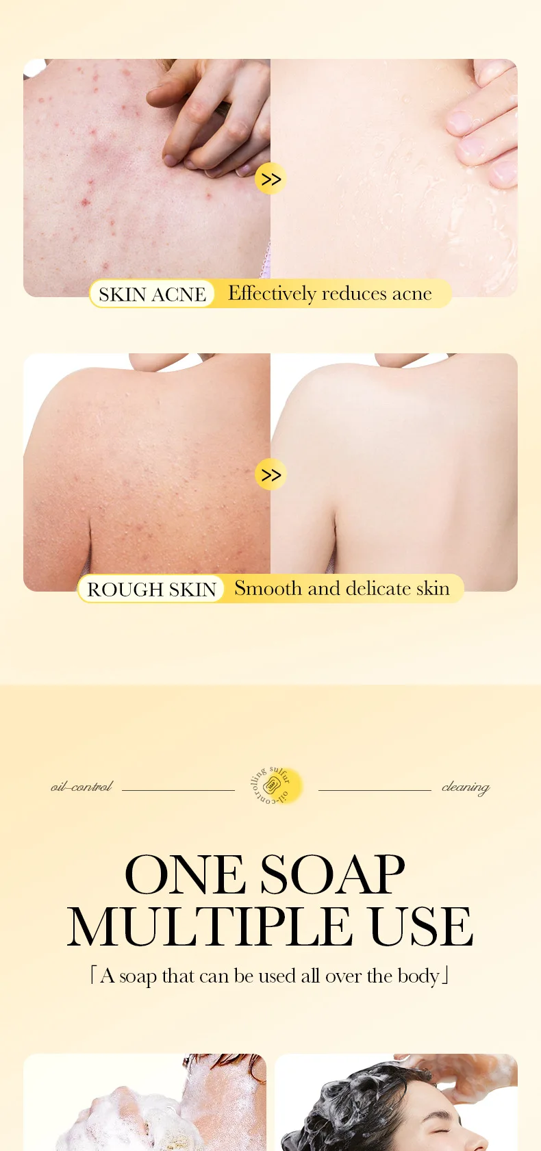 SADOER Sulfur Soap Bar product information