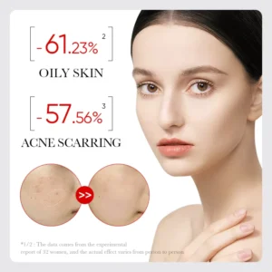 SADOER AHA Fruit Acid Face Serum infographic showing oily skin and acne scarring reduction with before-and-after photos.