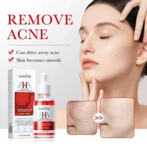 SADOER AHA Fruit Acid Face Serum showing acne removal and skin smoothing before and after results.