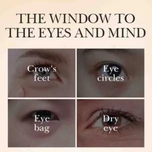 SADOER Caviar Tricolor Eye Cream targeting crow's feet, dark circles, eye bags, and dryness.