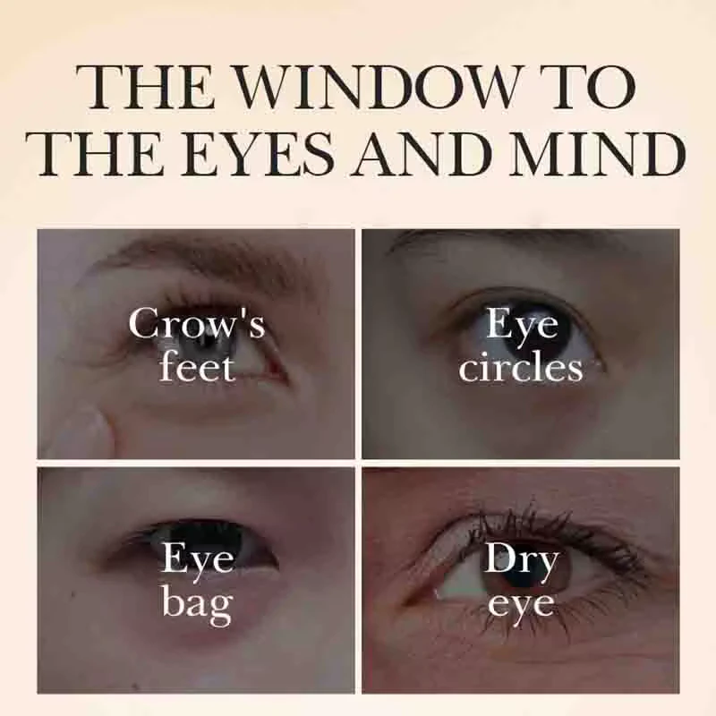 SADOER Caviar Tricolor Eye Cream targeting crow's feet, dark circles, eye bags, and dryness.