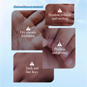 SADOER Coconut Oil Hand Mask addressing common hand issues like dryness, redness, and peeling.
