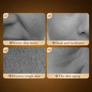 Skin laxity, dullness, and dryness addressed by SADOER Deep Collagen Vitamin C Face Cream.