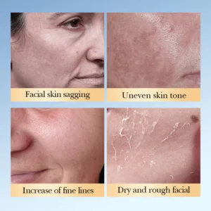 Skin sagging, uneven tone, fine lines, and dryness targeted by SADOER Glycolic Acid Facial Toner.