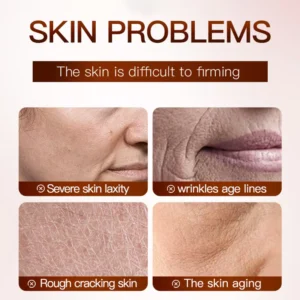 Skin concerns including wrinkles and laxity addressed by SADOER Iced Americano Caffeine Face Sheet Mask.