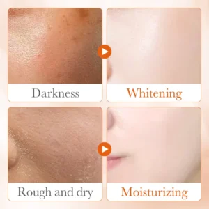 Before and after skin results using SADOER Vitamin C Face Serum for brightening and moisturizing.