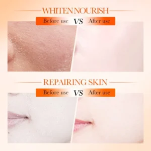 Before and after results showing skin brightening and repairing with SADOER Vitamin C Face Toner.
