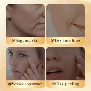 SADOER Yeast Collagen Eggshell Veil Cream targeting sagging, fine lines, wrinkles, and dry peeling skin.