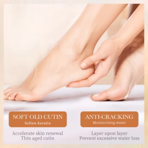 Hand massaging a foot, illustrating how SADOER Shea Butter Anti-Cracking Hand & Foot Cream softens old cutin.